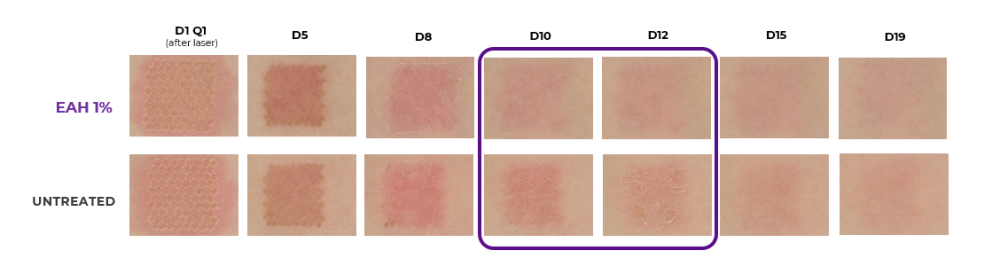 image EN crème épithéliale UR efficacité