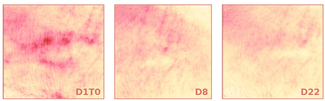 Résultats avec images, concentré apaisant