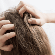 du_sensinol_silo_prurit_scalp_l2_header_icthing scalp 