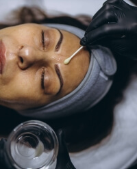 visuel peeling fiche conseil