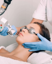 visuel laser fiche conseil