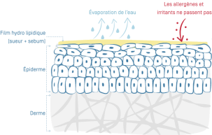 Eczéma Atopique - 01