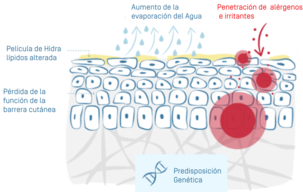 illu-eczema-atopique-02 1.