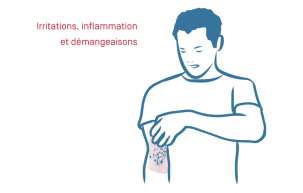 Eczéma Atopique - 03