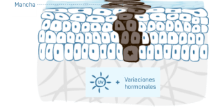 illu-taches-brunes-02 1