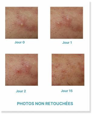 Visuel FICHE PRODUIT COMEDOMED PEELING