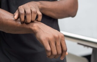 Comment soulager les démangeaisons au quotidien ?