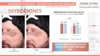 Proven post-injection efficacy