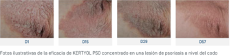 ES-Kertyol PSO Concentré · Efficacité.png
