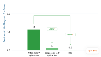 ES-Sensinol Lait · Desquamation.png