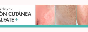 banner finale ES concours